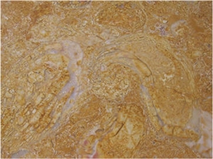 Amarelo De Negrais Limestone