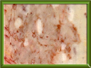 Rose Lakhssas Marble Slabs & Tiles, Morocco Pink Marble